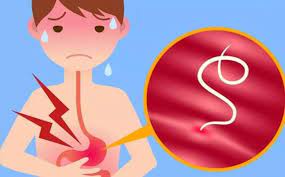 Sejak 3.000 SM: Bagaimana Parasit Mengubah Pandangan Manusia Tentang Penyakit