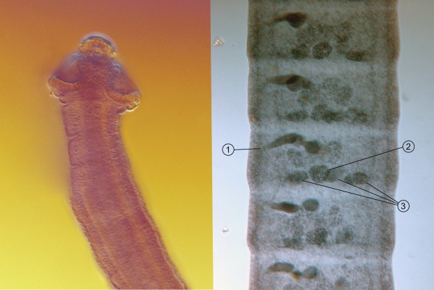 Selalu Lelah dan Bad Mood? Mungkin Bukan Cuma Stres, Tapi Parasit di Usus yang Sedang "Merampok" Sel Anda