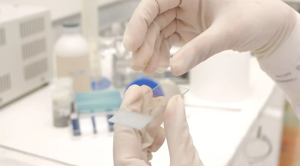 Bukan Sekadar Stres Kerja: Mengapa Warga Jakarta di April 2026 Kini Mulai Cek Laboratorium untuk “Parasit Pengatur Mood”?